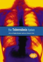The_tuberculosis_update