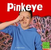 Pinkeye
