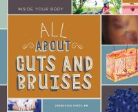 All_about_cuts_and_bruises